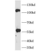 WB analysis of A549 cells, using TLR8 antibody (1/1000 dilution).