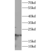 WB analysis of Jurkat cells, using CD3E antibody (1/1000 dilution).