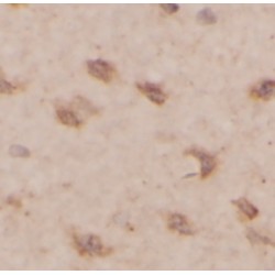 Homeobox Protein OTX2 (OTX2) Antibody