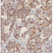 IHC-P analysis of human tonsillitis tissue, using CD21 antibody (1/200 dilution).