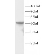 WB analysis of HeLa cells, using CSNK2A1 antibody (1/1000 dilution).