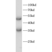 WB analysis of Mouse liver, using EGLN1 antibody (1/1000 dilution).