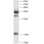 WB analysis of rat heart tissue, using FABP4 antibody (1/1000 dilution).