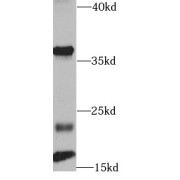 WB analysis of HeLa cells, using FGF2 antibody (1/1000 dilution).