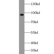 WB analysis of PC12 cells, using FGFR2(Phospho-Ser782) antibody (1/1500 dilution).