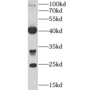WB analysis of mouse heart tissue, using FGF23 antibody (1/1000 dilution).