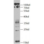 WB analysis of SW480 cells, using UBB antibody (1/1000 dilution).