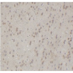 Mitogen-Activated Protein Kinase 11 (MAPK11) Antibody