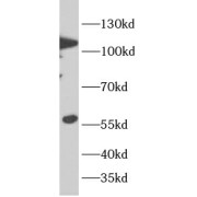 WB analysis of mouse kidney tissue, using KLOT antibody (1/1000 dilution).