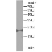 WB analysis of mouse brain, using LMO4 antibody (1/1000 dilution).