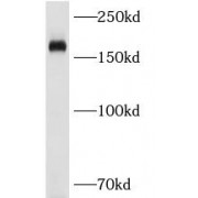 WB analysis of Mouse liver, using CD206 antibody (1/1000 dilution).