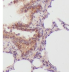 RNA-Binding Protein Musashi Homolog 1 (MSI1) Antibody