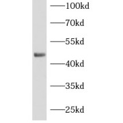 WB analysis of A549 cells, using MSI1 antibody (1/1000 dilution).