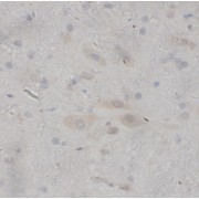 IHC-P analysis of Rat brain tissue, using NDF1 antibody (1/200 dilution).