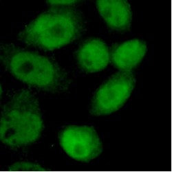 Neurofibromin (NF1) Antibody