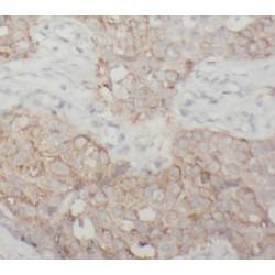 Neurofibromin (NF1) Antibody