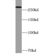 WB analysis of HeLa cells, using NF1 antibody (1/600 dilution).