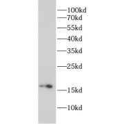 WB analysis of Raji cells, using RHEB antibody (1/600 dilution).