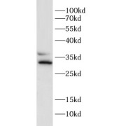 WB analysis of MCF-7 cell lysates, using HAX1 antibody (1/1000 dilution).