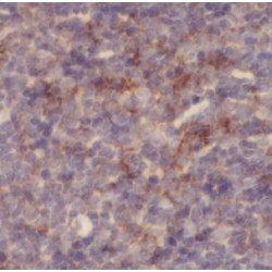 Tumor Necrosis Factor Receptor Superfamily Member 9 / CD137 (TNFRSF9) Antibody