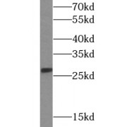 WB analysis of mouse spleen tissue, using CD137 antibody (1/1000 dilution).