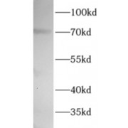 WB analysis of Jurkat cells, using WEE1 antibody (1/1000 dilution).