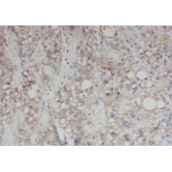 Abelson Tyrosine-Protein Kinase 2 (ABL2) Antibody