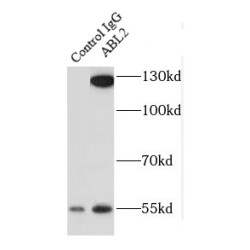 Abelson Tyrosine-Protein Kinase 2 (ABL2) Antibody