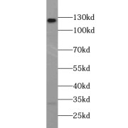 WB analysis of HeLa cells, using ABL2 antibody (1/500 dilution).