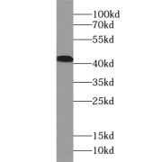 WB analysis of HeLa cells, using ACAA2 antibody (1/500 dilution).