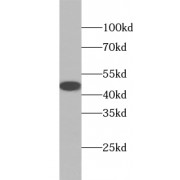 WB analysis of mouse pancreas tissue, using ACAD8 antibody (1/500 dilution).