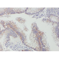 ACADL-Specific Antibody