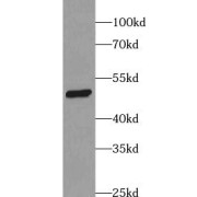 WB analysis of mouse kidney tissue, using ACADL-Specific antibody (1/300 dilution).