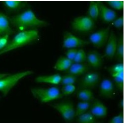 Acyl-CoA Dehydrogenase, Short Chain (ACADS) Antibody