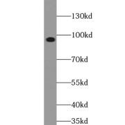 WB analysis of Jurkat cells, using ACAP3 antibody (1/500 dilution).