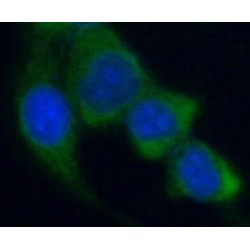 Acetyl-CoA Carboxylase 1 (ACC1) Antibody