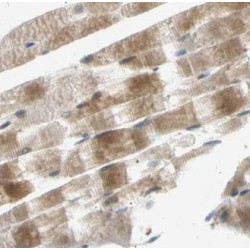 Acetyl-CoA Carboxylase 1 (ACC1) Antibody