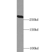 WB analysis of HeLa cells, using ACC1 antibody (1/500 dilution).