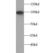 WB analysis of mouse brain tissue, using CNNM1 antibody (1/1000 dilution).