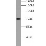 WB analysis of SH-SY5Y cells, using ACK1 antibody (1/500 dilution).