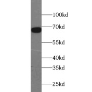 WB analysis of Transfected HEK-293 cells, using ACOT11 antibody (1/1000 dilution).