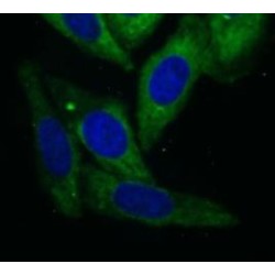 Acyl-CoA Thioesterase 2 (ACOT2) Antibody