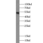 WB analysis of human brain tissue, using ACOT2 antibody (1/500 dilution).