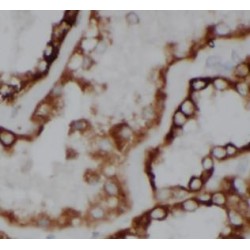 Acyl-CoA Thioesterase 6 (ACOT6) Antibody