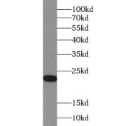 WB analysis of mouse liver tissue, using ACOT6 antibody (1/1000 dilution).