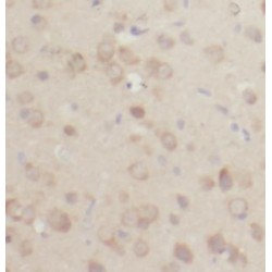 Acyl-CoA Thioesterase 7 (ACOT7) Antibody