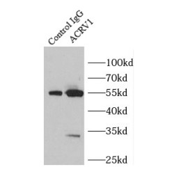 Activin Receptor Type I (ACRV1) Antibody