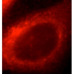 Acyl-CoA Synthetase Medium-Chain Family Member 3 (ACSM3) Antibody