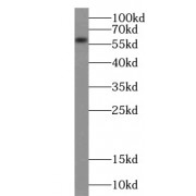 WB analysis of HEK-293 cells, using ACSM3 antibody (1/500 dilution).