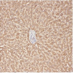 Acyl-CoA Synthetase Short-Chain Family Member 3 (ACSS3) Antibody